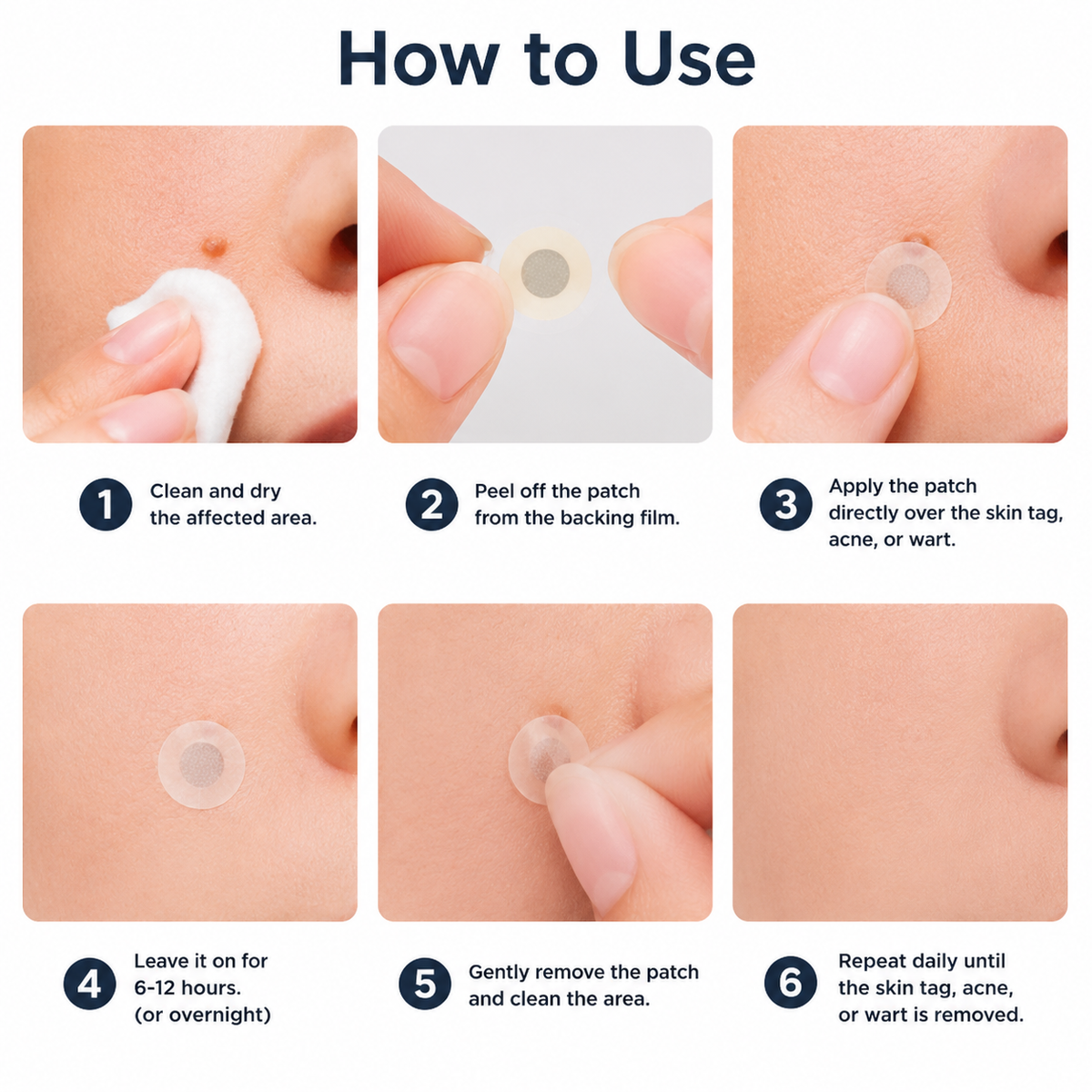 🏥 Curalona® 2-in-1 Microneedle & Hydrocolloid Patches 🍀 | Targets Skin Tags, Flat Warts & Raised Bumps | Invisible Face & Body Patches | No Clinic Visit Needed