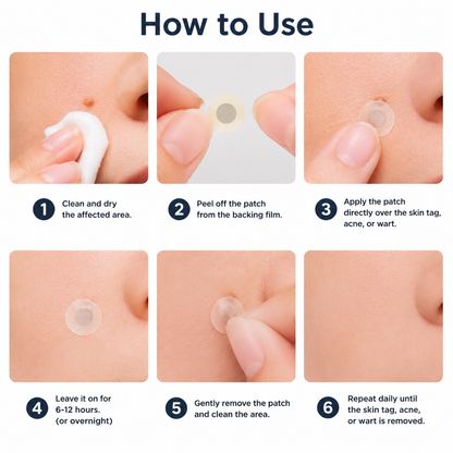 🏥 Curalona® 2-in-1 Microneedle & Hydrocolloid Patches 🍀 | Targets Skin Tags, Flat Warts & Raised Bumps | Invisible Face & Body Patches | No Clinic Visit Needed
