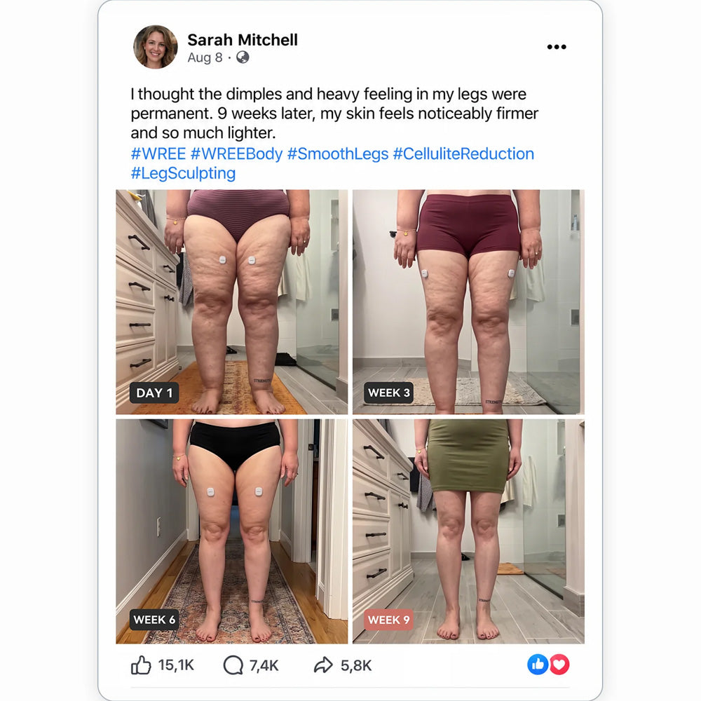 Mresio® ✨ Micro-RF Körperkonturierung & Lymphdrainage Gerät