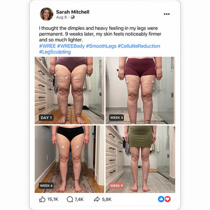 Mresio® ✨ Micro-RF Körperkonturierung & Lymphdrainage Gerät