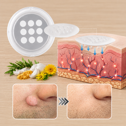 🏥 Curalona® 2-in-1 Microneedle & Hydrocolloid Patches 🍀 | Targets Skin Tags, Flat Warts & Raised Bumps | Invisible Face & Body Patches | No Clinic Visit Needed