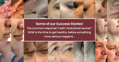 🏥 Curalona® 2-in-1 Microneedle & Hydrocolloid Patches 🍀 | Targets Skin Tags, Flat Warts & Raised Bumps | Invisible Face & Body Patches | No Clinic Visit Needed